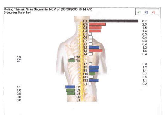 Thermal Chart